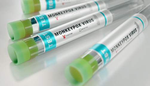 monkeypox virus